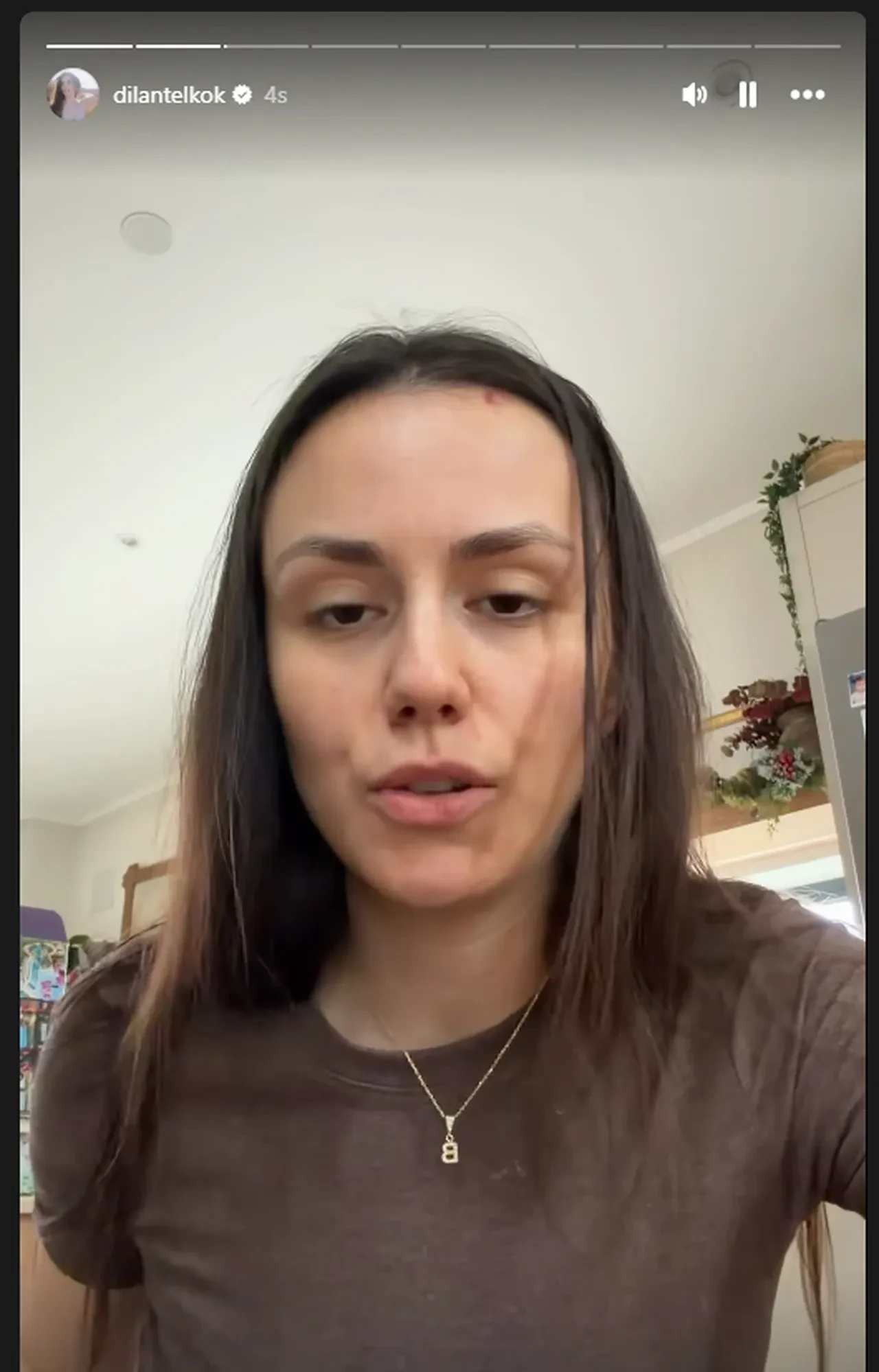 Dilan Telkök ve Berkay Hardal çifti ölümden döndü! "Çok büyük bir kazaydı"