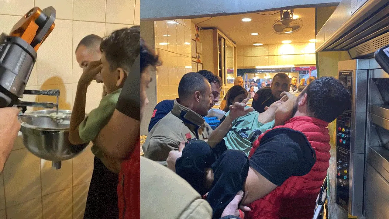 Merakın sonu acı bitti! Küçük çocuk elini hamur yoğurma makinesine kaptırdı