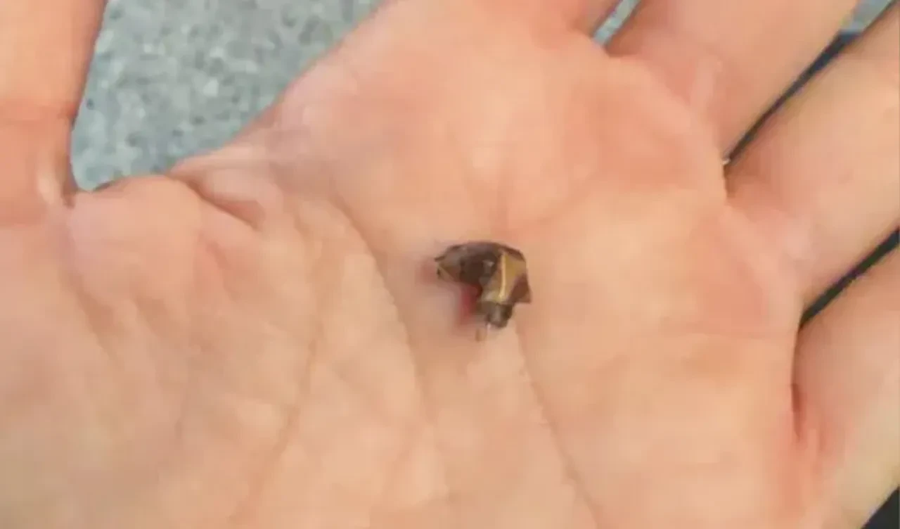 Otuz beş sene solunum sıkıntısı çekti: Burnundan çıkan herkesi şoke etti