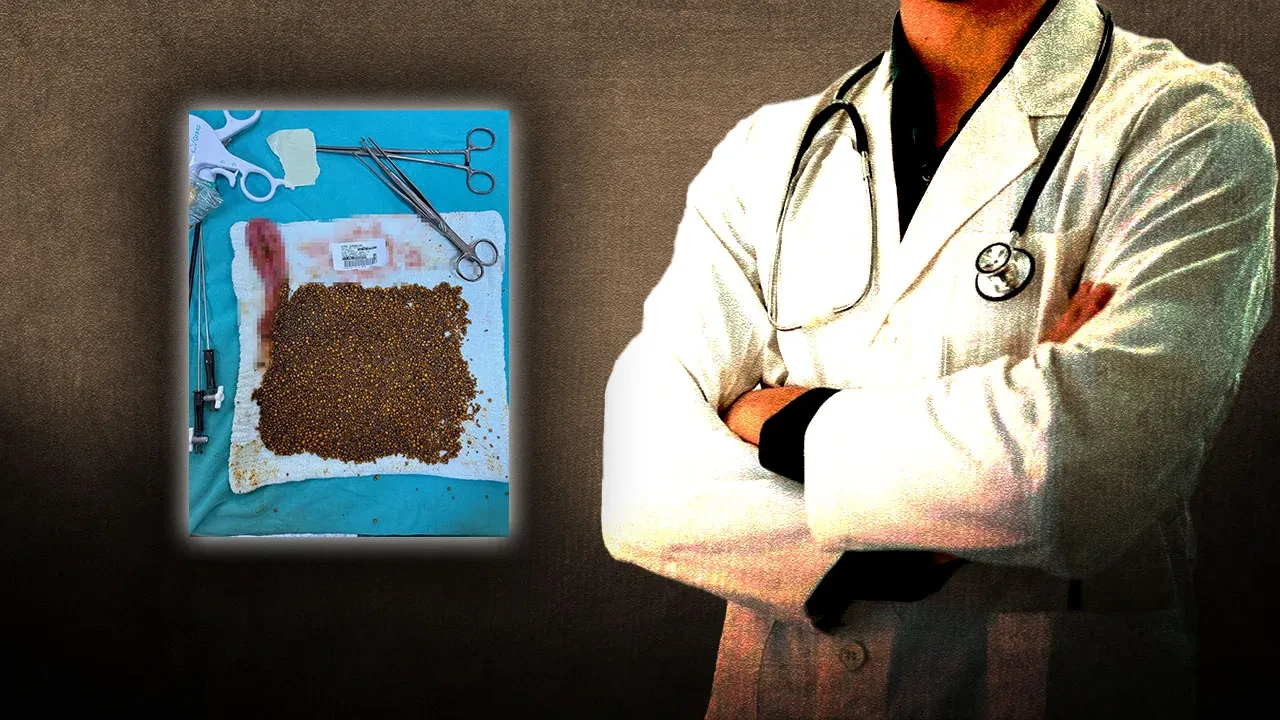 Böyle vaka görülmedi! Doktorları şaşkına çeviren ameliyat: Gözlerine inanamadılar