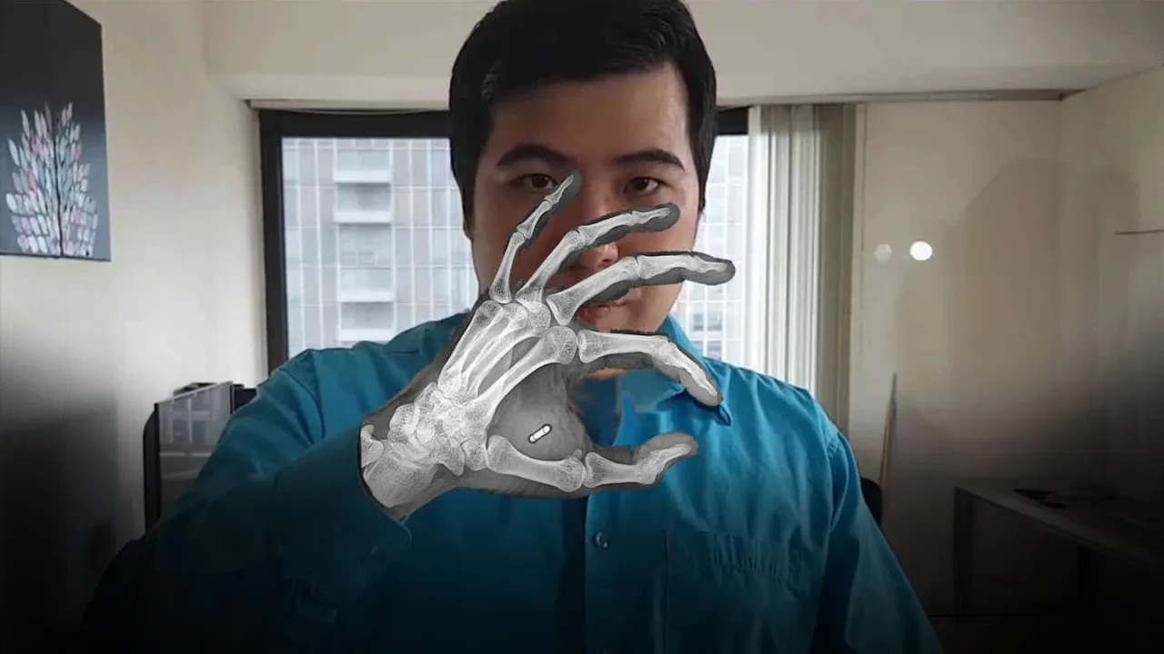 Vücuduna çip taktırdı, şifreyi unutunca hayatı kabusa döndü