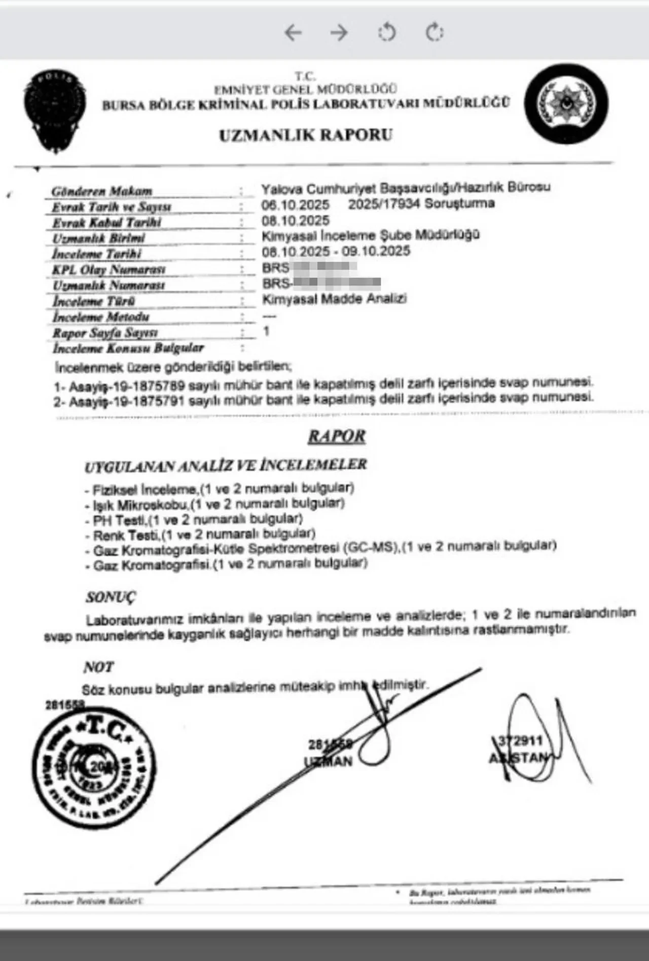 Güllü'nün düşüşünde en merak edilen soru cevap buldu! Bu yüzden mi kaydı?