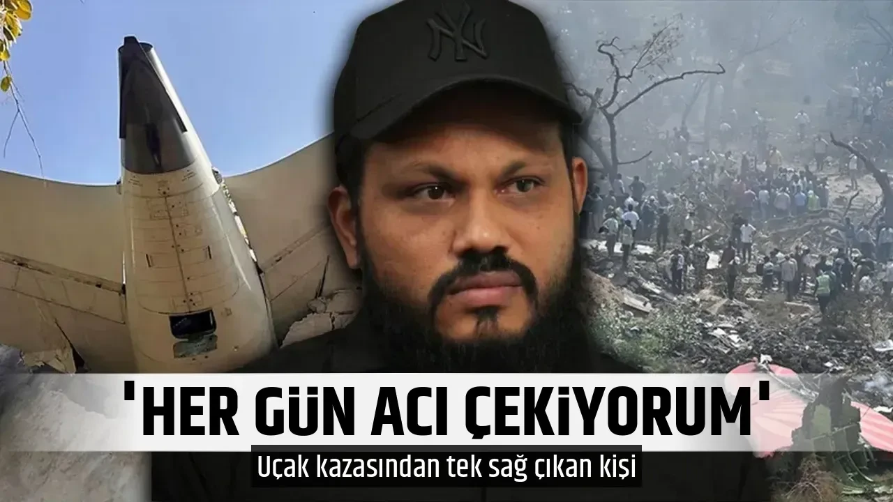 'HER GÜN ACI ÇEKİYORUM'