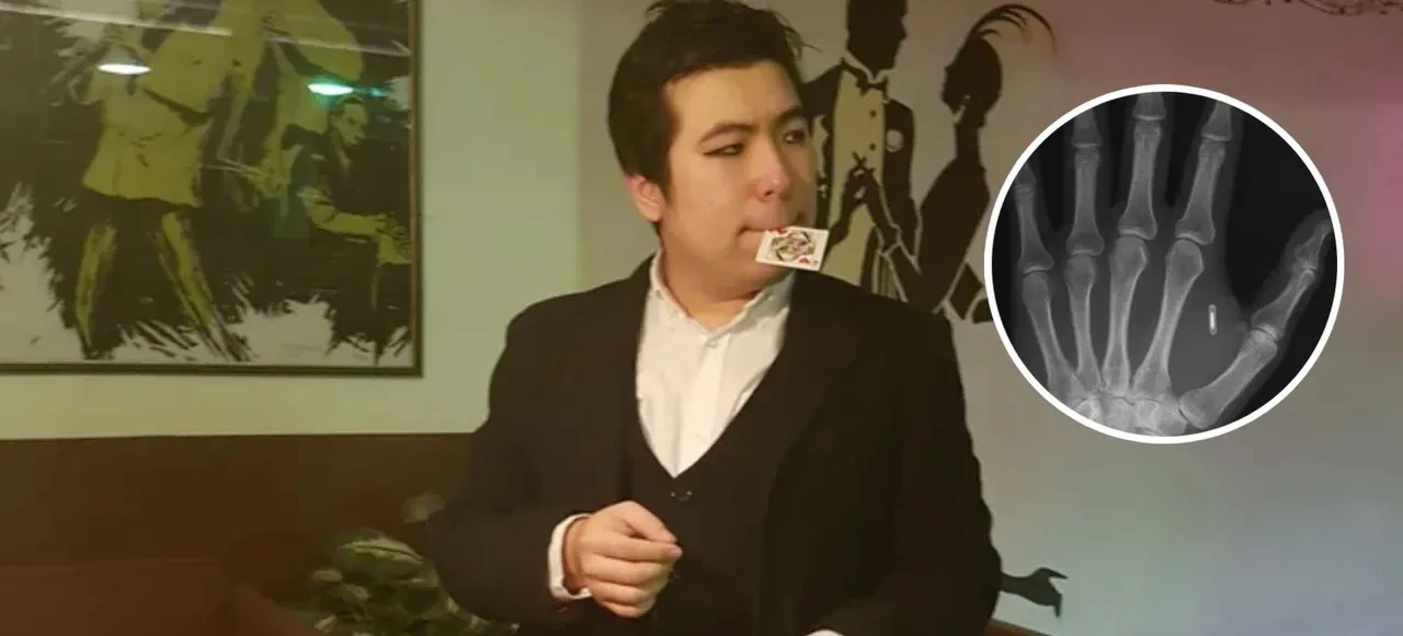 Eline taktırdığı çipin parolasını unuttu! Genç adamın başına gelen komik ve şaşırtıcı olay