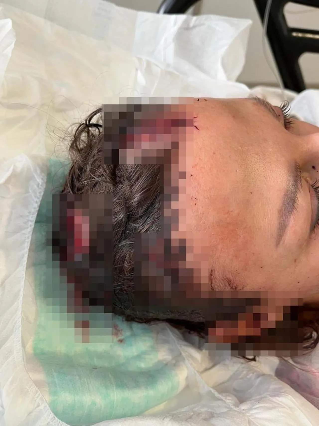 Antalya'da koca dehşeti! Ukraynalı eşini öldüresiye dövmüştü: Yeni görüntüler ortaya çıktı