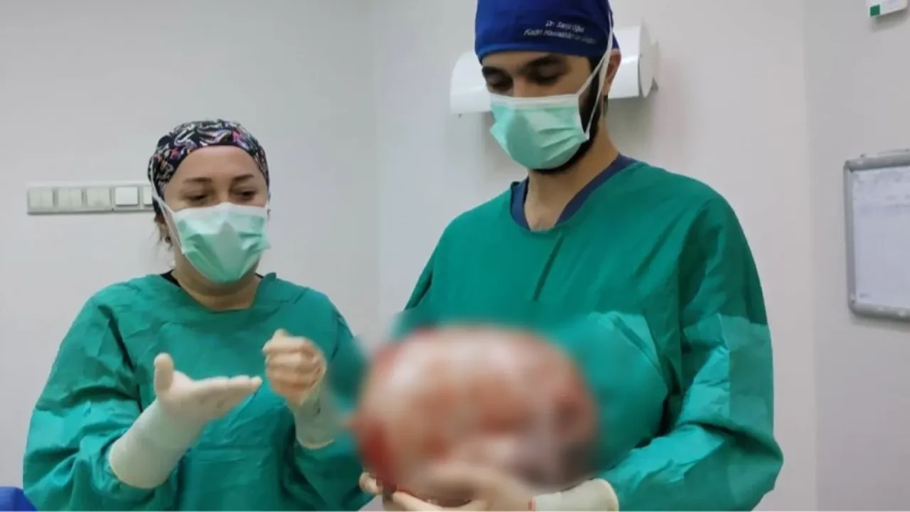 Karnı 9 aylık hamile gibi şişti! Doktorlar bile inanamadı: Tam 8,5 kilo 