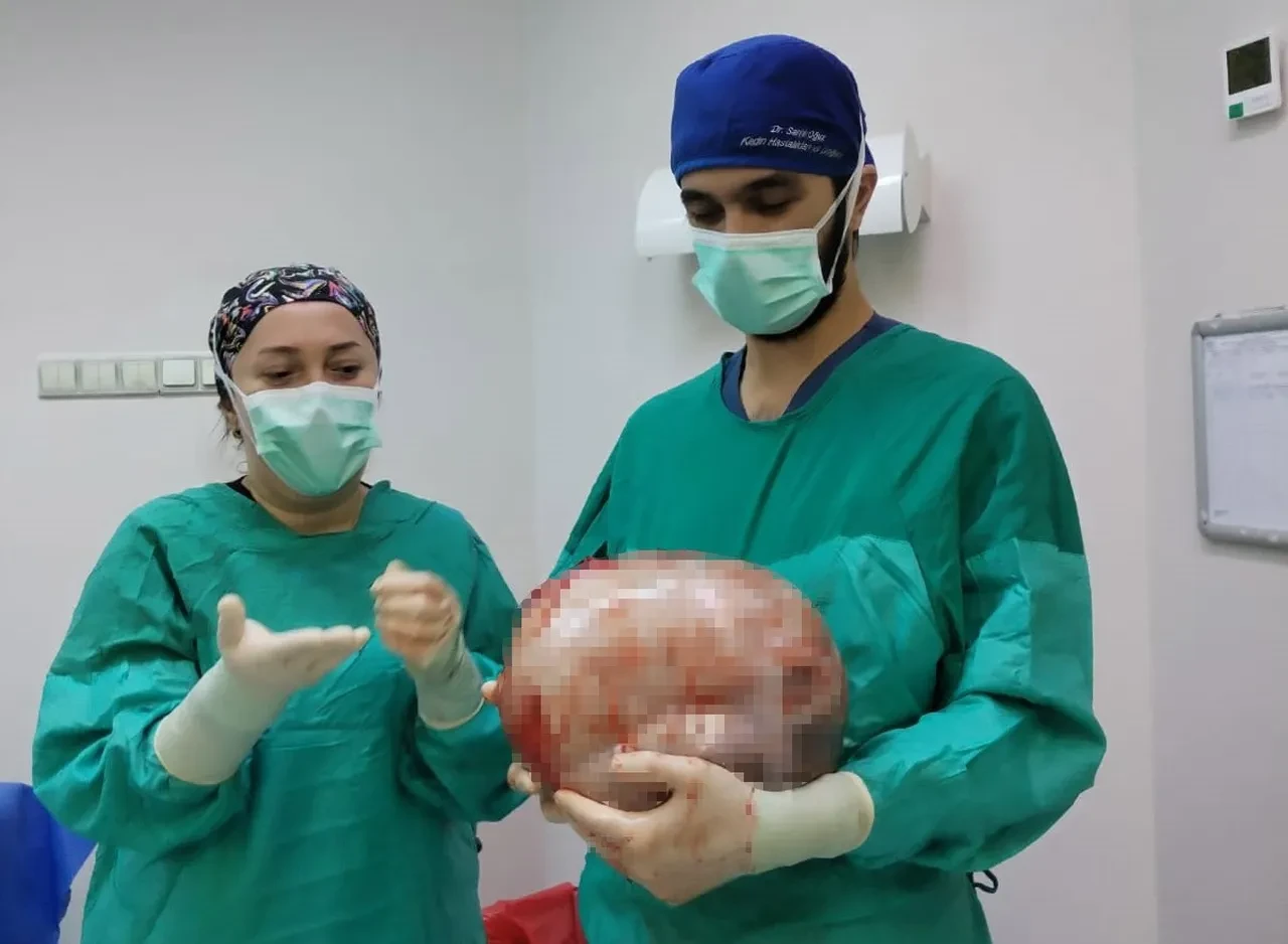 Karnı 9 aylık hamile gibi şişti! Doktorlar bile inanamadı: Tam 8,5 kilo