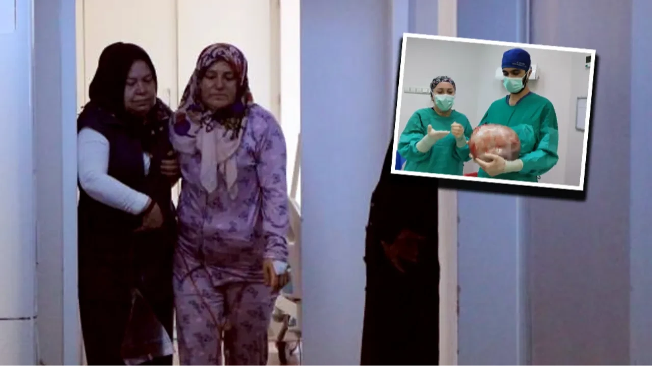 Karnı 9 aylık hamile gibi şişti! Doktorlar bile inanamadı: Tam 8,5 kilo 