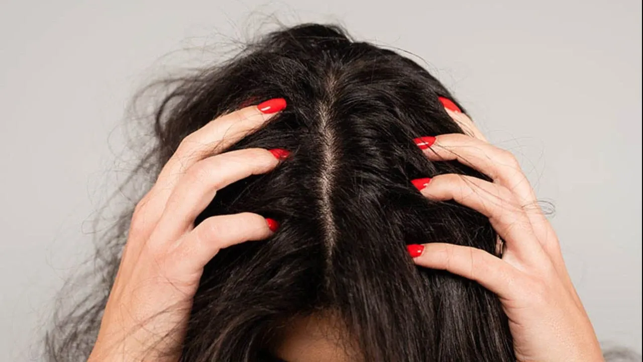 Mevsim geçişinde kepek kabusu yaşayanlar dikkat! Asyalıların sır gibi sakladığı o yöntem ortaya çıktı