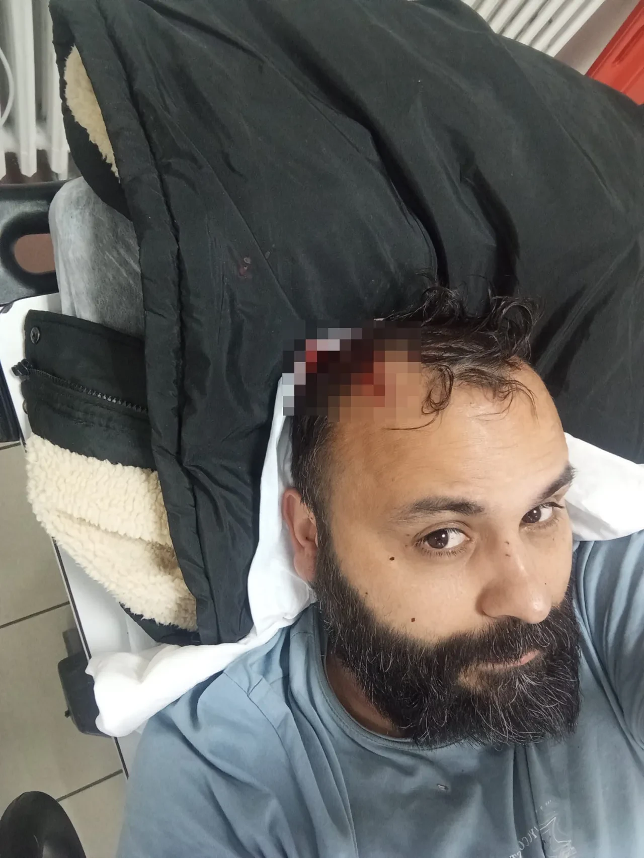 Sosyal medya fenomeni dehşeti yaşadı! Eski eşi ve ailesi tarafından öldüresiye dövüldü: O anlar kamerada