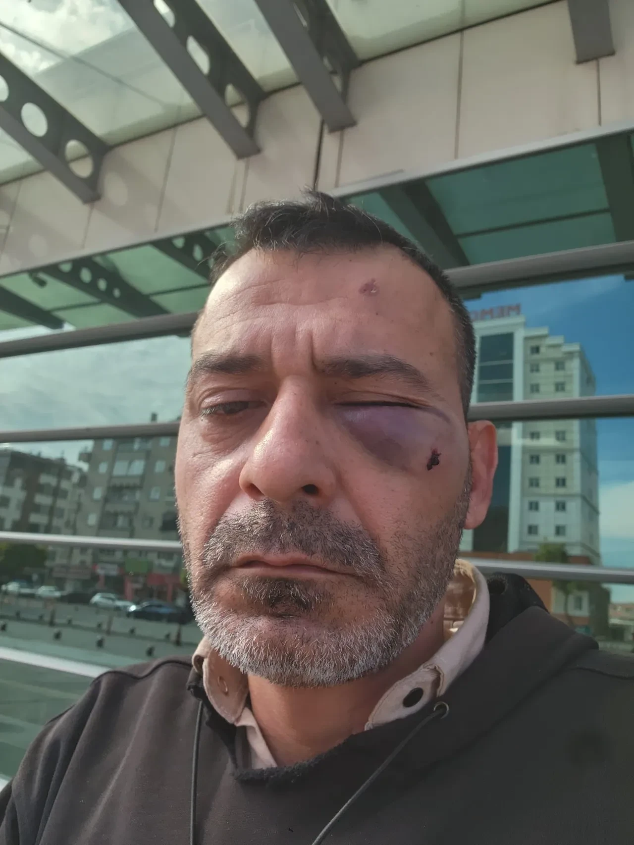 Sosyal medya fenomeni dehşeti yaşadı! Eski eşi ve ailesi tarafından öldüresiye dövüldü: O anlar kamerada