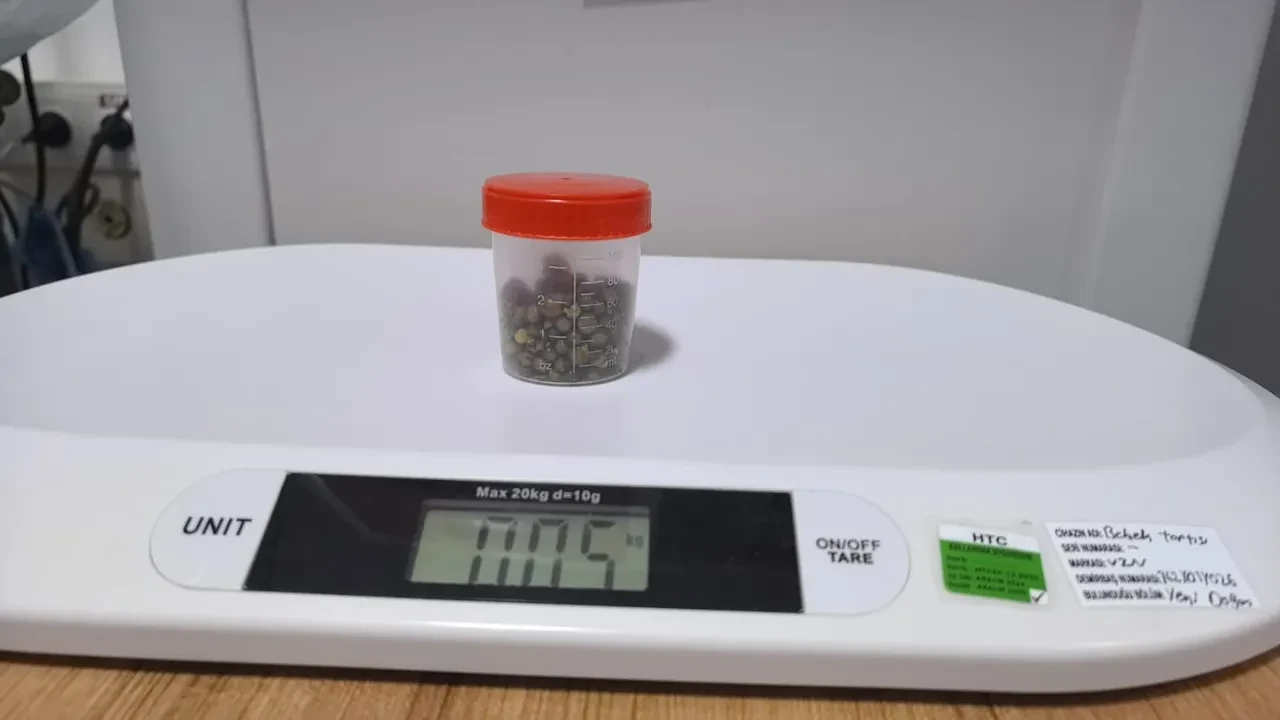 Doktorlar şaşkına döndü, tek tek karnından çıkardılar! Tam 213 tane çıktı