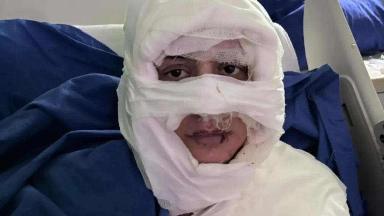 Kadıköy'de korkunç saldırı! Eğlence mekanı önünde kadına yanıcı madde döküp yaktı