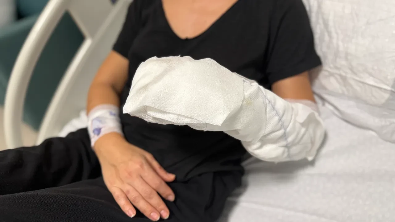 Dekoratif şömine bomba gibi patladı! Genç kadının vücudunun yüzde 30’u yandı