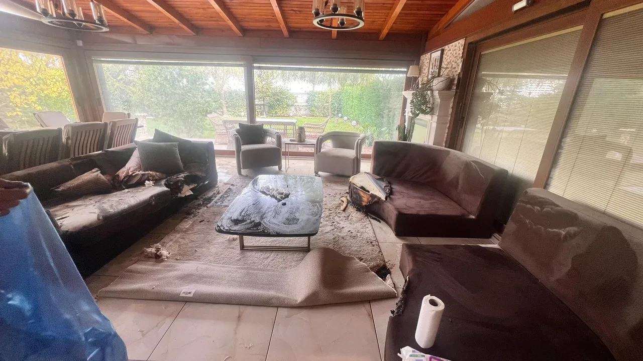 Dekoratif şömine bomba gibi patladı! Genç kadının vücudunun yüzde 30’u yandı