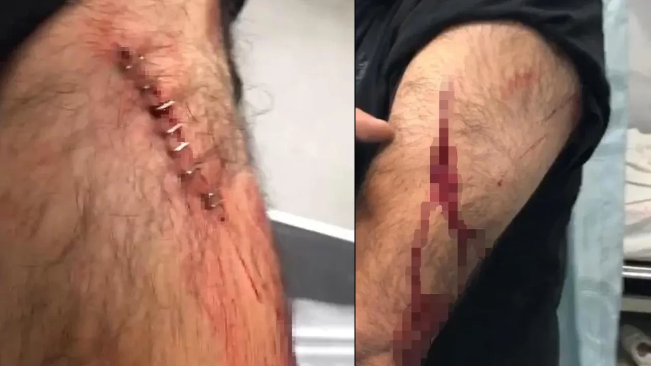 Şanlıurfa'da öğretmen dehşeti yaşadı! Para vermeyince jiletle saldırdı