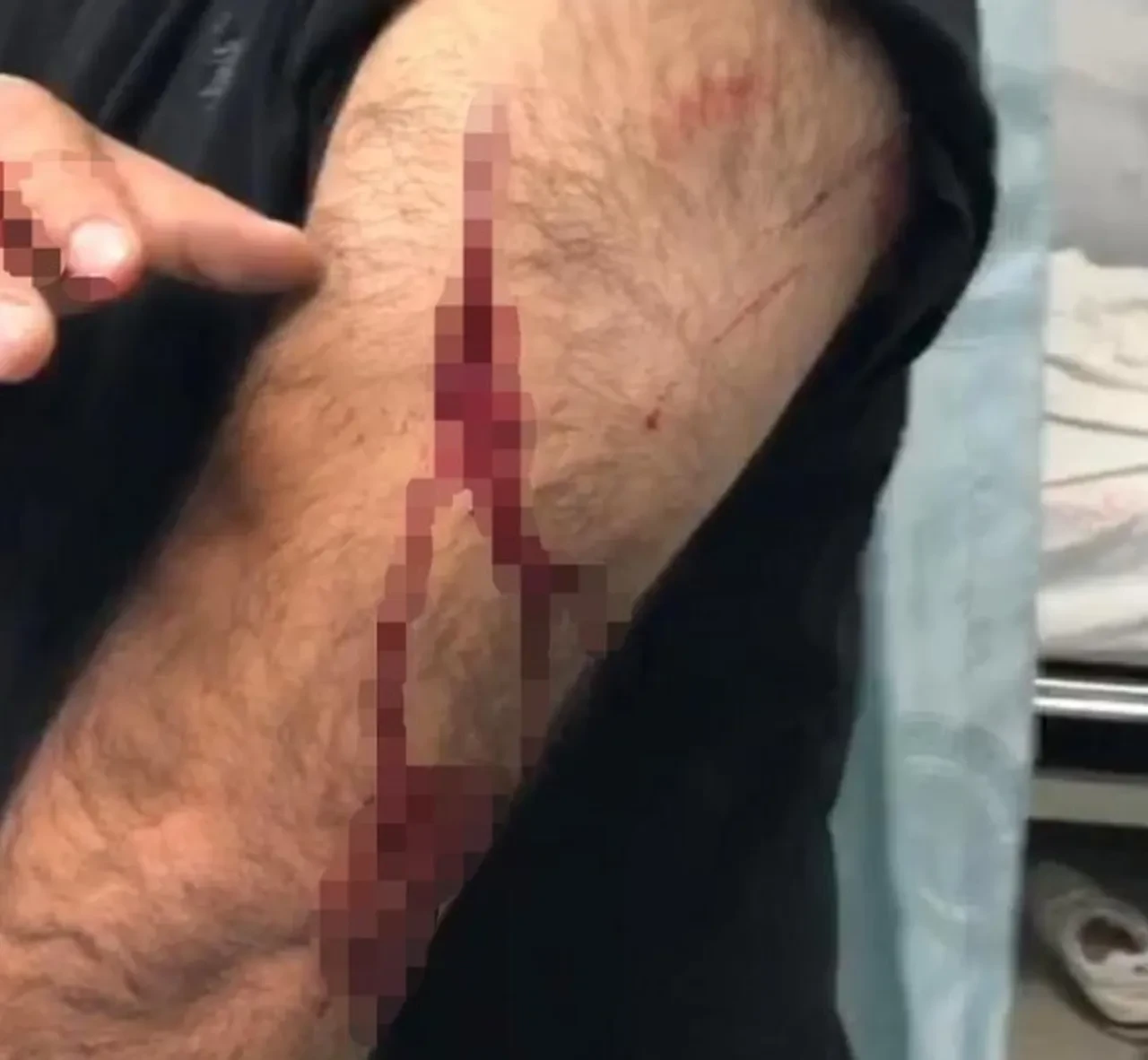 Şanlıurfa'da öğretmen dehşeti yaşadı! Para vermeyince jiletle saldırdı