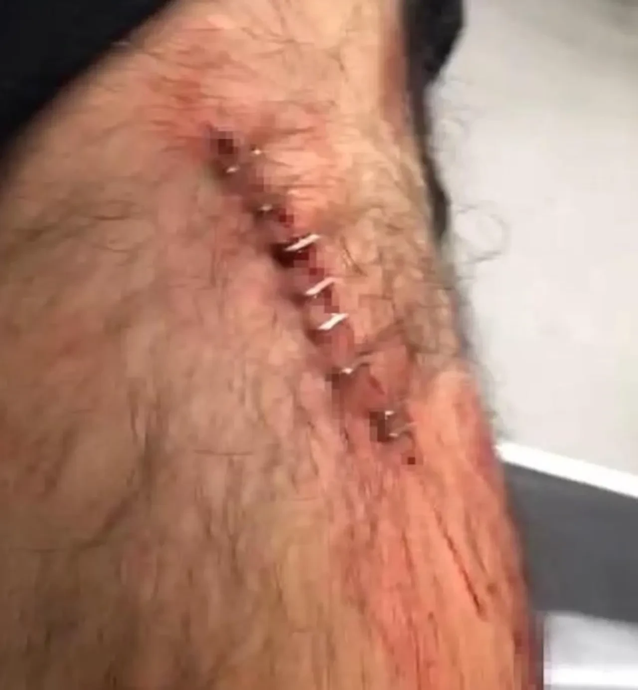 Şanlıurfa'da öğretmen dehşeti yaşadı! Para vermeyince jiletle saldırdı