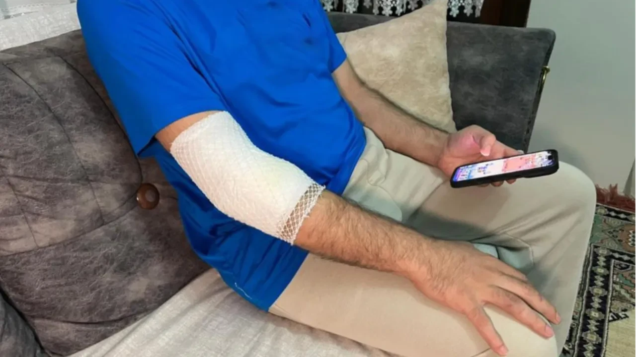 Güvenlikli sitede köpek saldırısı! 'Öyle bir ısırmış ki kemikleri görünüyordu'