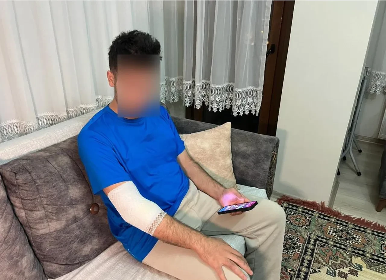 Güvenlikli sitede köpek saldırısı! 'Öyle bir ısırmış ki kemikleri görünüyordu'