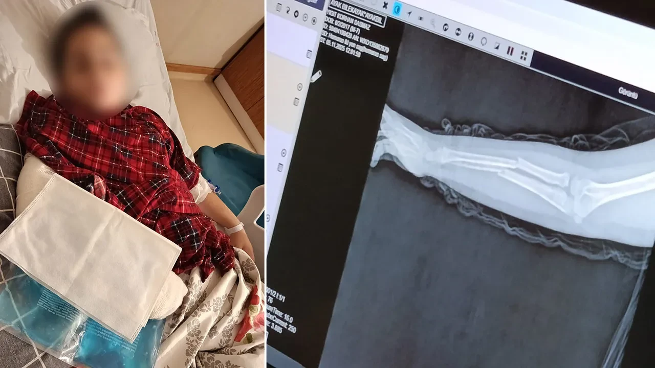 İlkokulda dehşet: 9 yaşındaki çocuk arkadaşının kolunu 2 yerden kırdı, sözleri şoke etti! 'İntikamımı aldım'
