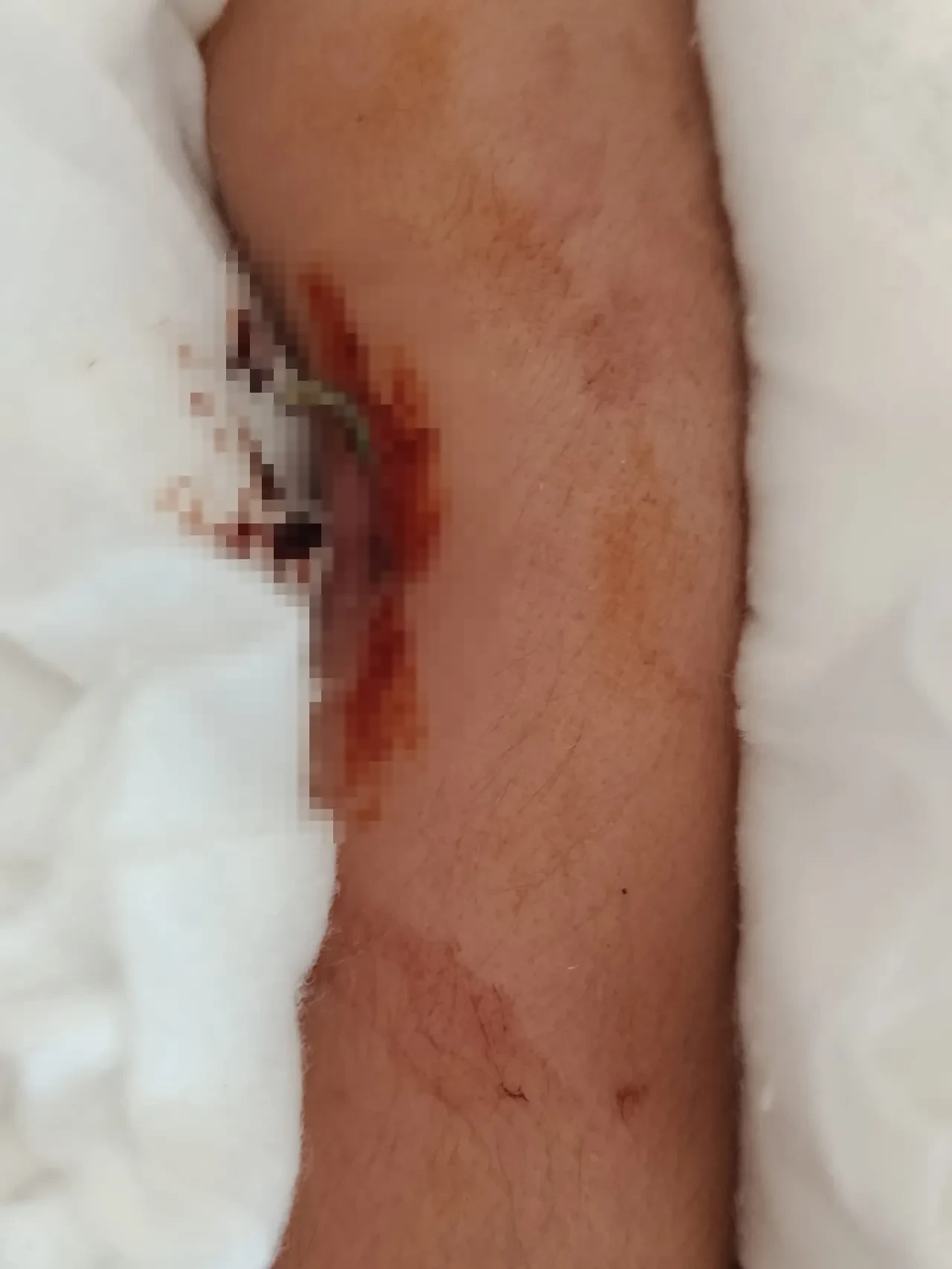 İlkokulda dehşet: 9 yaşındaki çocuk arkadaşının kolunu 2 yerden kırdı, sözleri şoke etti! 'İntikamımı aldım'