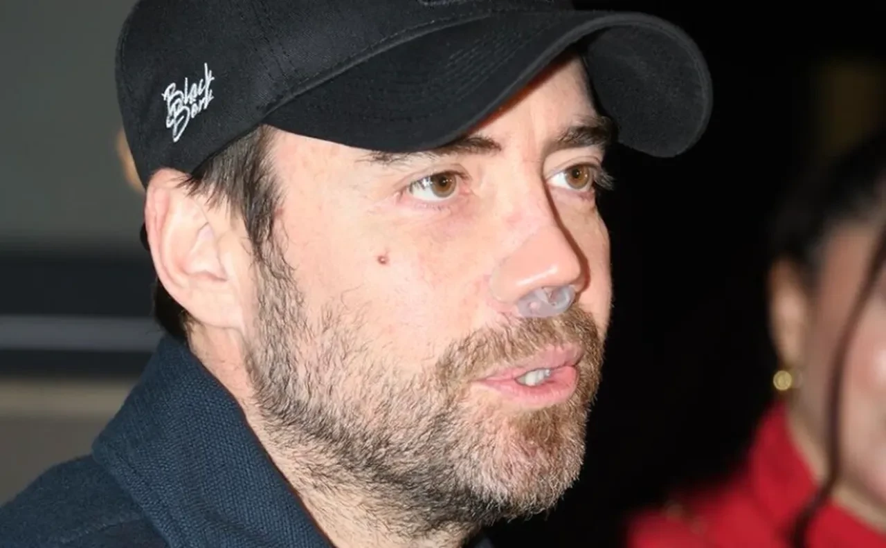 Sayısız burun ameliyatı olan Murat Dalkılıç'ın son halini görenler şaştı kaldı