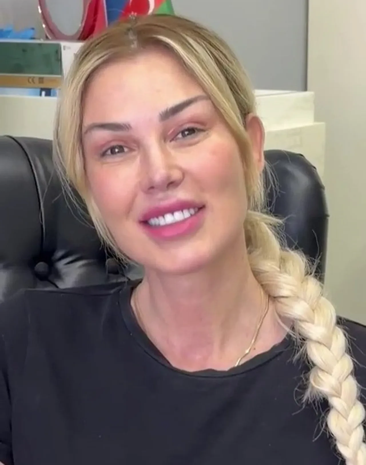 Petek Dinçöz geçirdiği estetik operasyon sonrası ilk kez makyajsız görüntülendi