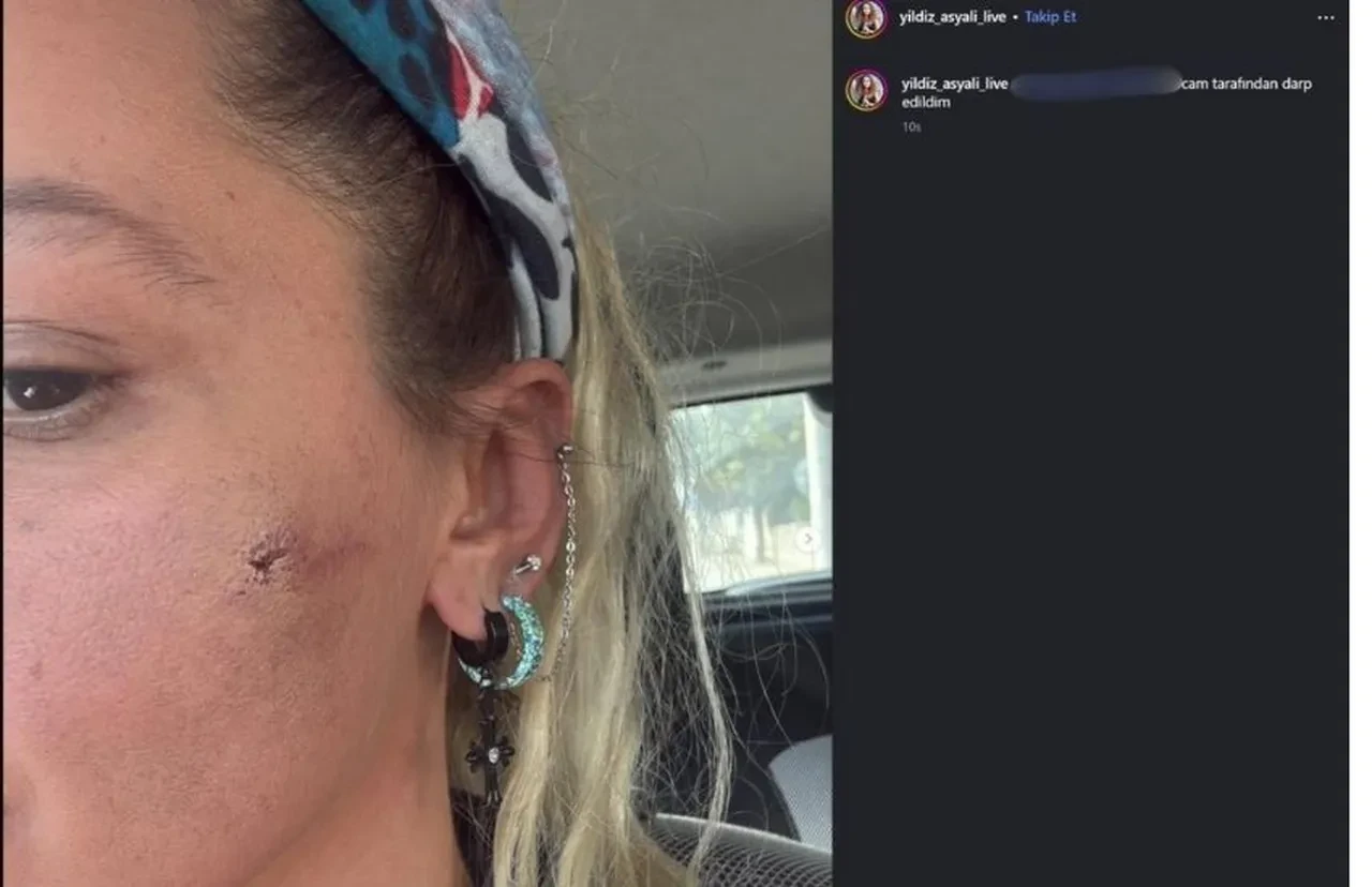 Yıldız Asyalı'dan endişelendiren paylaşım! "Umarım başıma daha kötü şeyler gelmez"