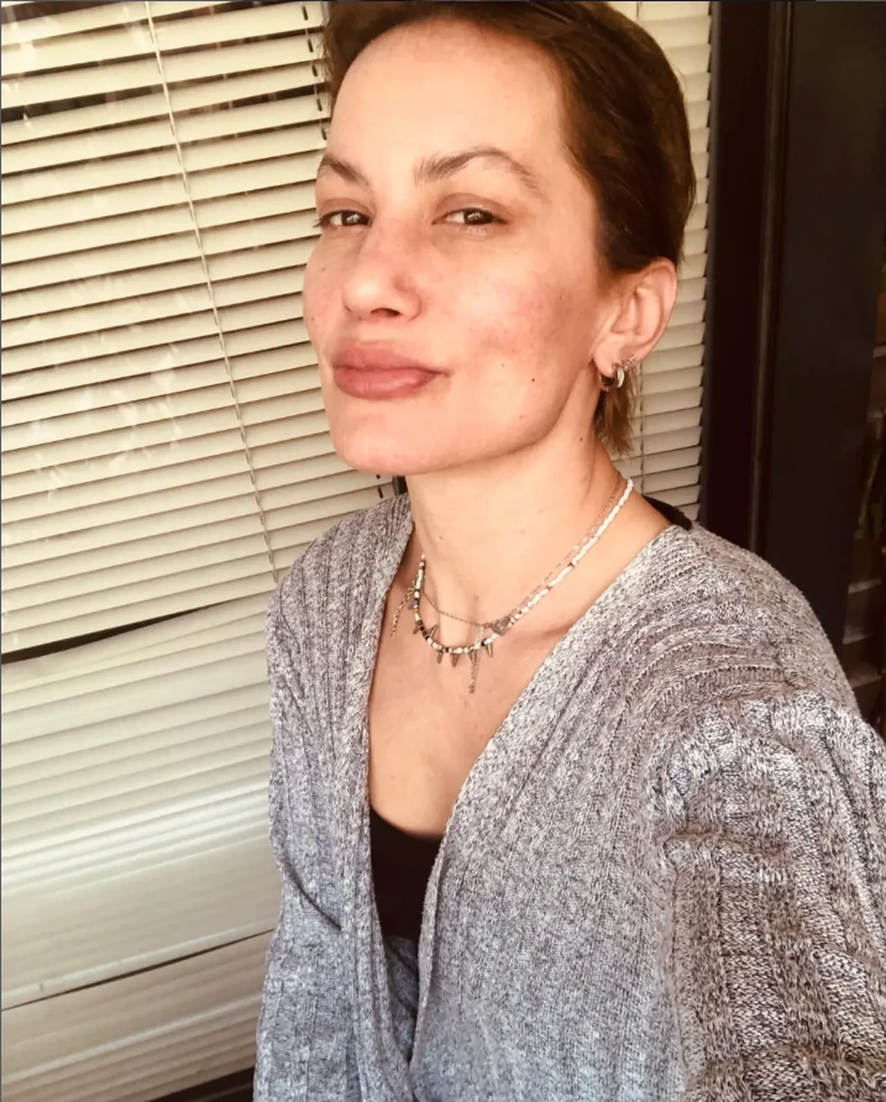 Yıldız Asyalı'dan endişelendiren paylaşım! "Umarım başıma daha kötü şeyler gelmez"