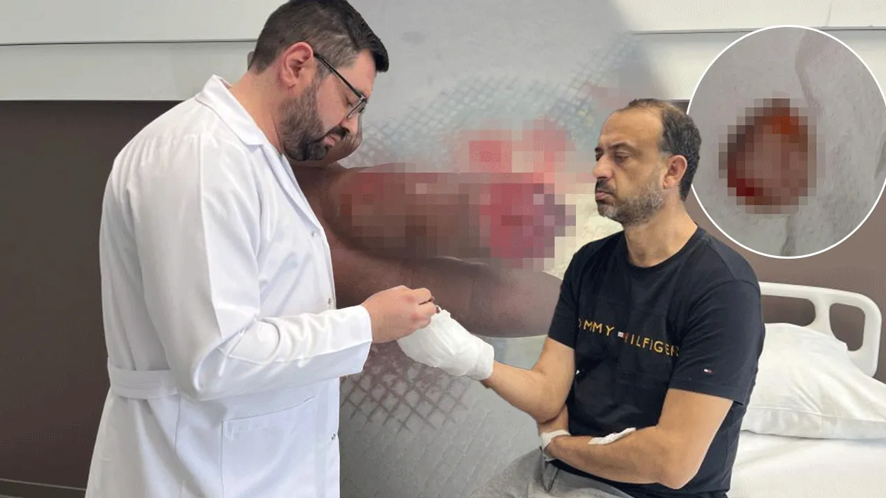 Buz poşetindeki parmağıyla 600 km'lik yolculuk yaptı! Bulgaristan'da dikemediler Türkiye'ye geldi! 