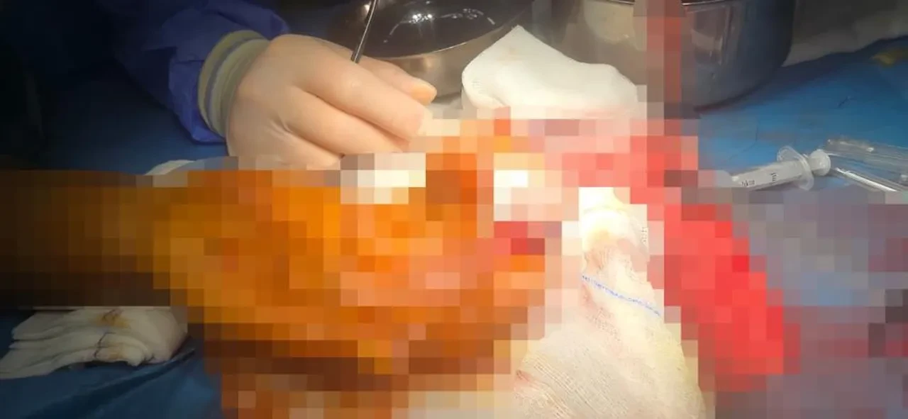 Buz poşetindeki parmağıyla 600 km'lik yolculuk yaptı! Bulgaristan'da dikemediler Türkiye'ye geldi! 