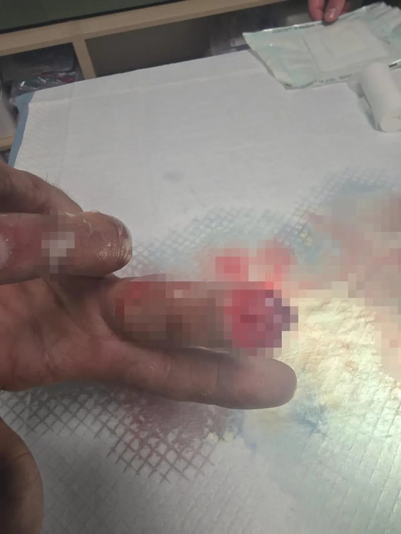 Buz poşetindeki parmağıyla 600 km'lik yolculuk yaptı! Bulgaristan'da dikemediler Türkiye'ye geldi! 