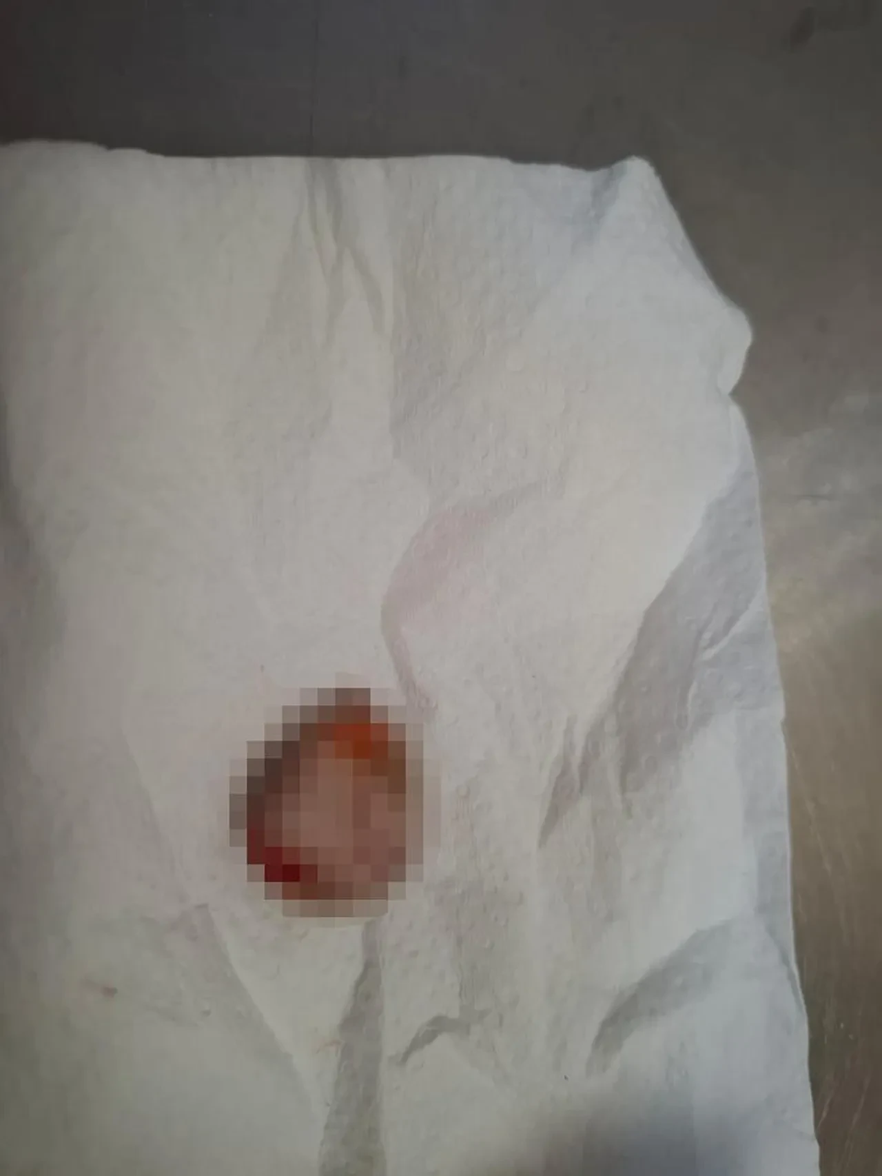 Buz poşetindeki parmağıyla 600 km'lik yolculuk yaptı! Bulgaristan'da dikemediler Türkiye'ye geldi! 