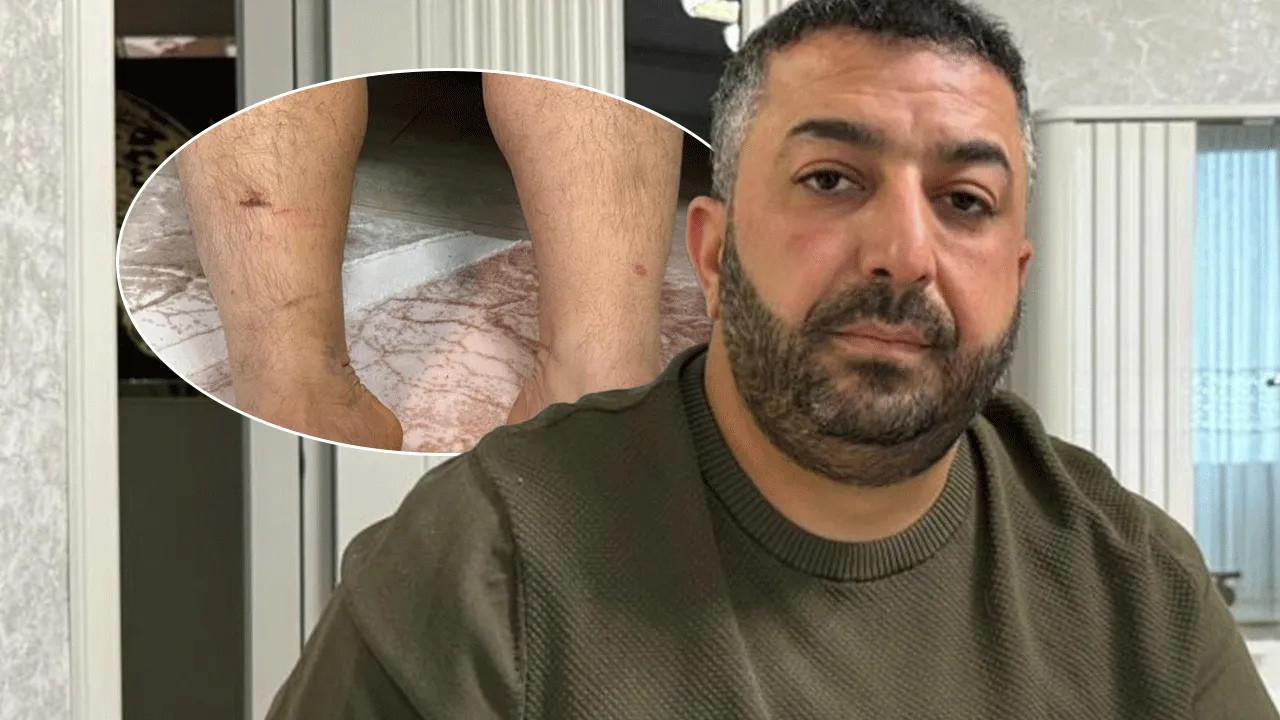 Diyarbakır'da dehşete düşüren olay! 'Beni icraya verdin' diyerek kuzenlerine 8 saat işkence ettiler