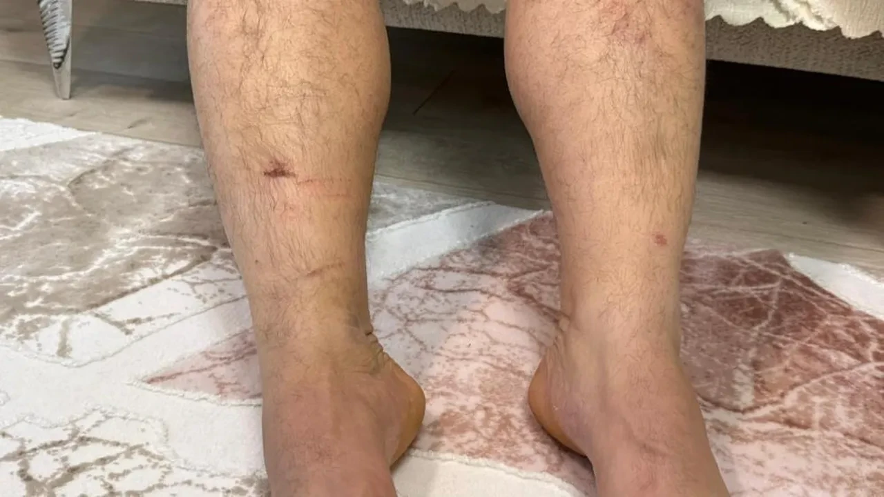 Diyarbakır'da dehşete düşüren olay! 'Beni icraya verdin' diyerek kuzenlerine 8 saat işkence ettiler