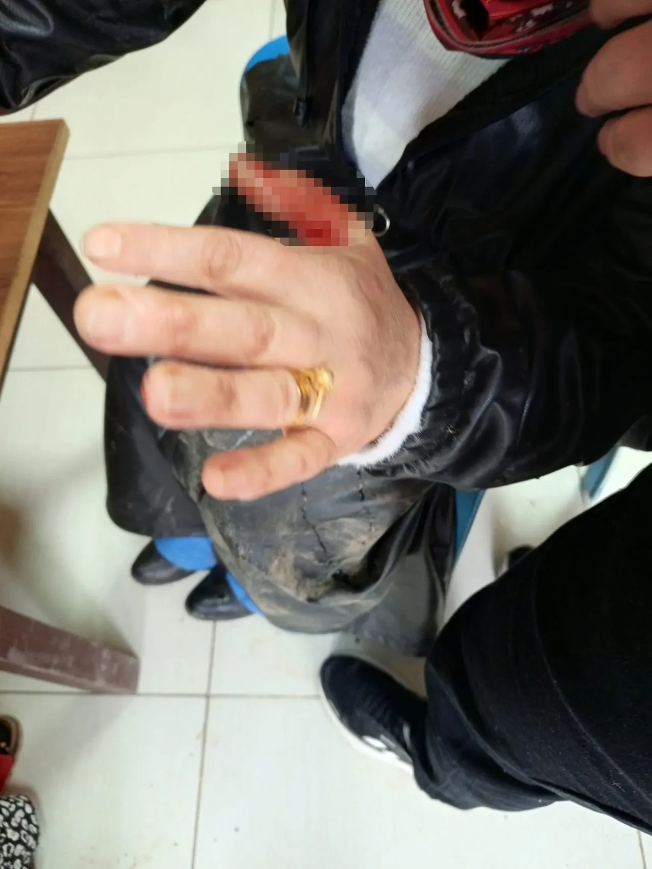 Başıboş sokak köpeği dehşeti! Yaralılara yardıma koşan kalabalığa da saldırdılar