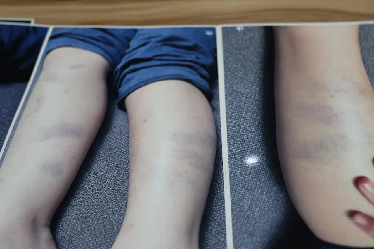 Aile okulu, okul aileyi suçladı! Özel okulda darp iddiası!