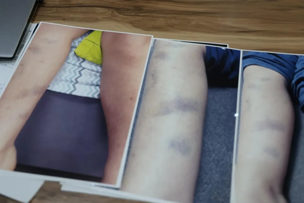 Aile okulu, okul aileyi suçladı! Özel okulda darp iddiası!