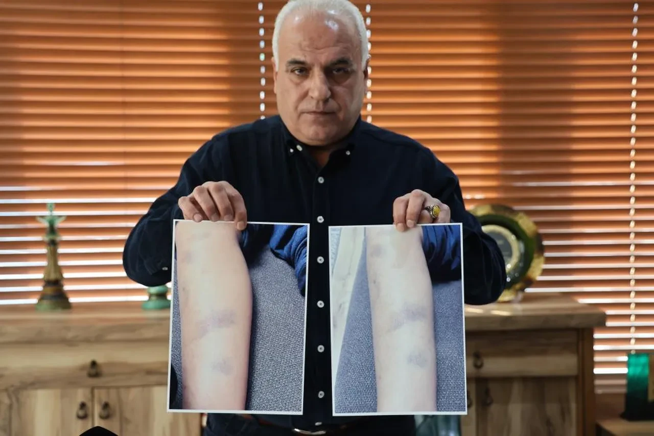 Aile okulu, okul aileyi suçladı! Özel okulda darp iddiası!