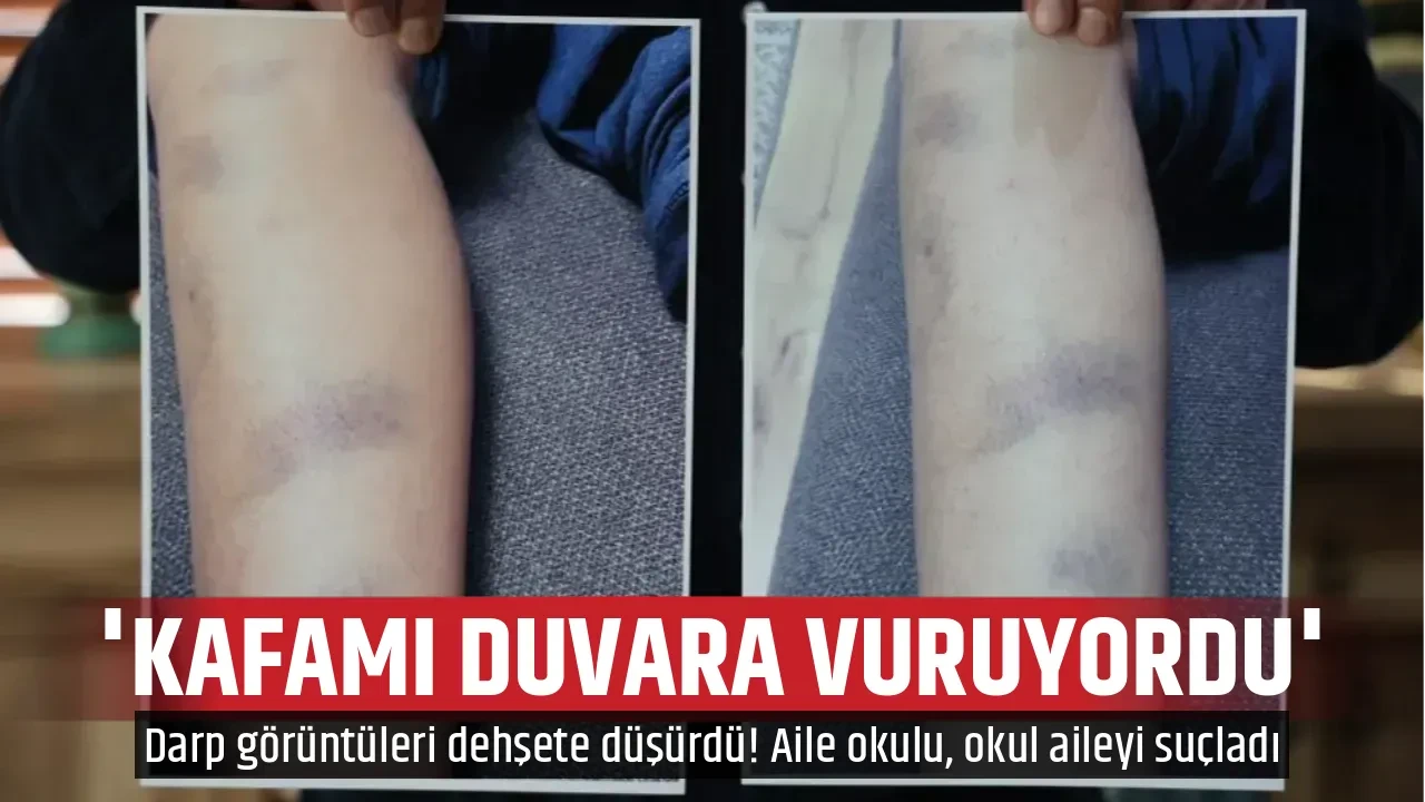 'KAFAMI DUVARA VURUYORDU'