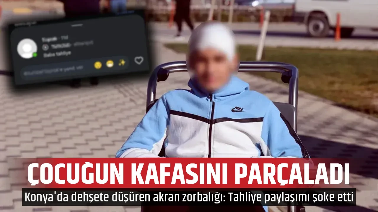 ÇOCUĞUN KAFASINI PARÇALADI