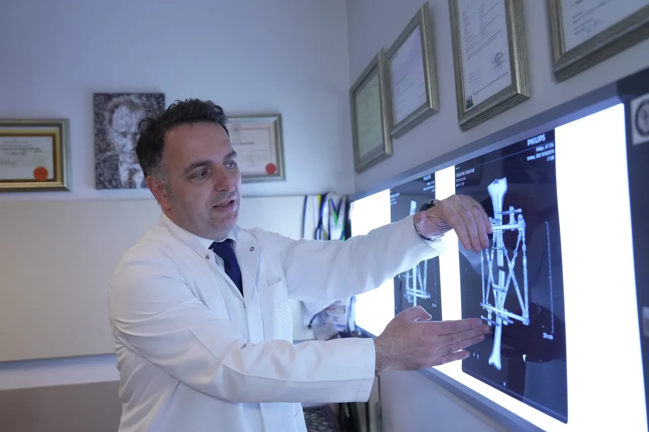 Boy kısalığına karşı modern çözüm: Kemik uzatma yöntemleri!