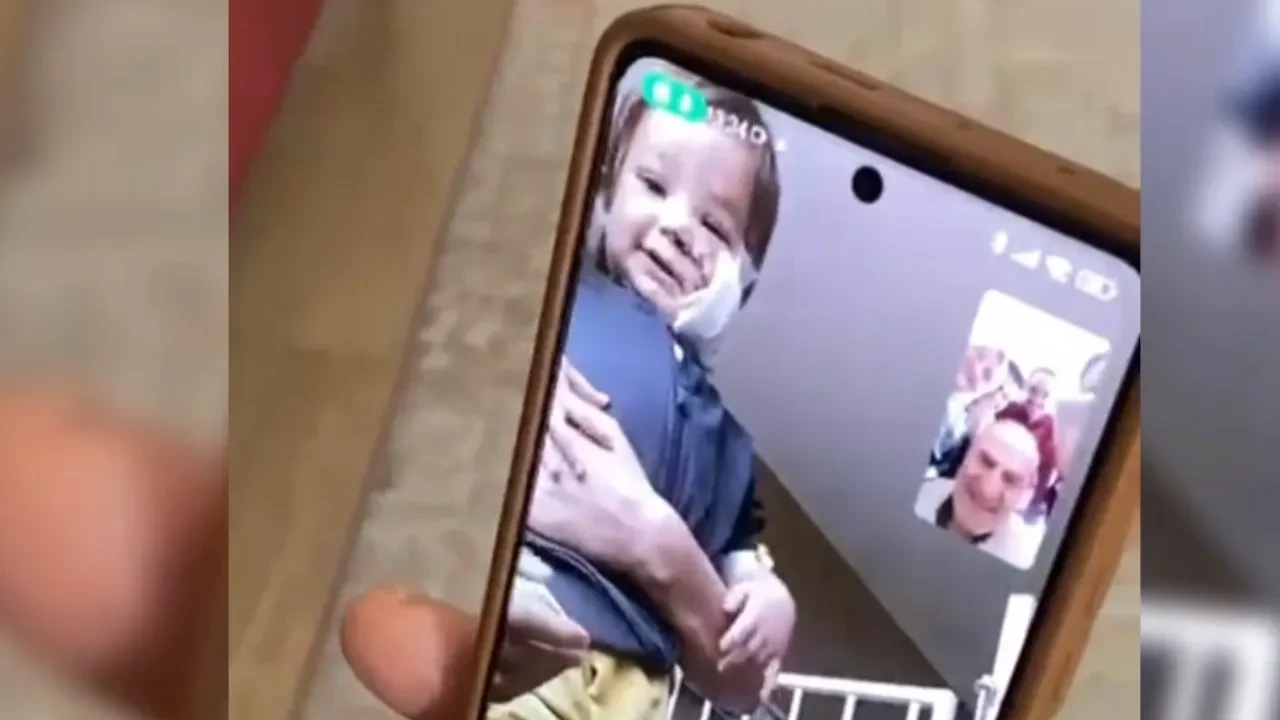 Pitbull yüzünü parçalamıştı! İşte Minik Efe'nin son hali 