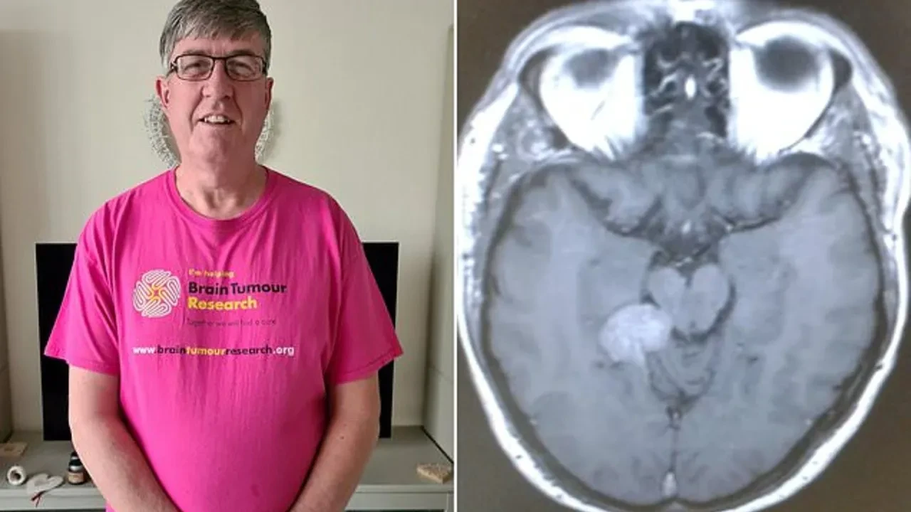 Masum bir kulak çınlaması sandı, altından büyük bir hastalık çıktı: Gerçek, MR taramasında görüldü