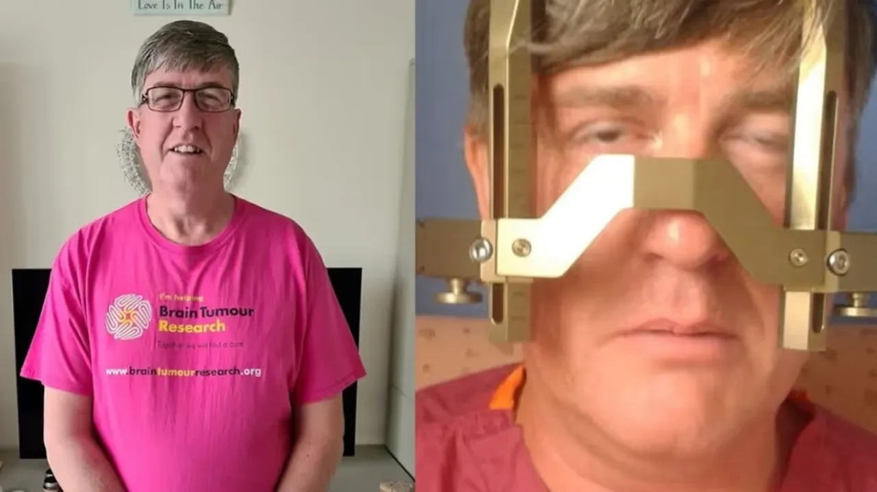 Masum bir kulak çınlaması sandı, altından büyük bir hastalık çıktı: Gerçek, MR taramasında görüldü