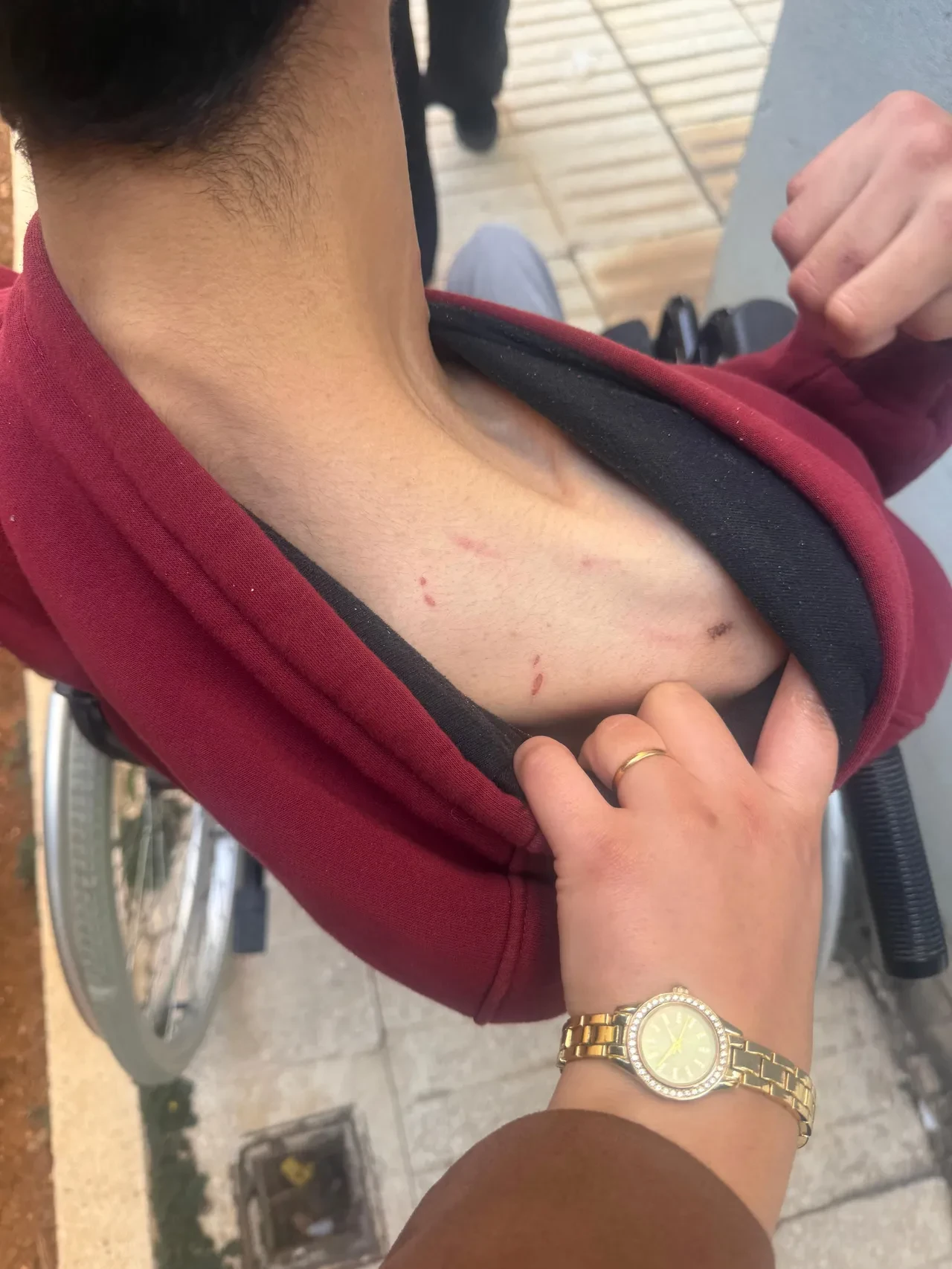 Bakım merkezinde korkunç darp! Engelli gence yapmadıkları kalmamış: Aile dehşete düştü 