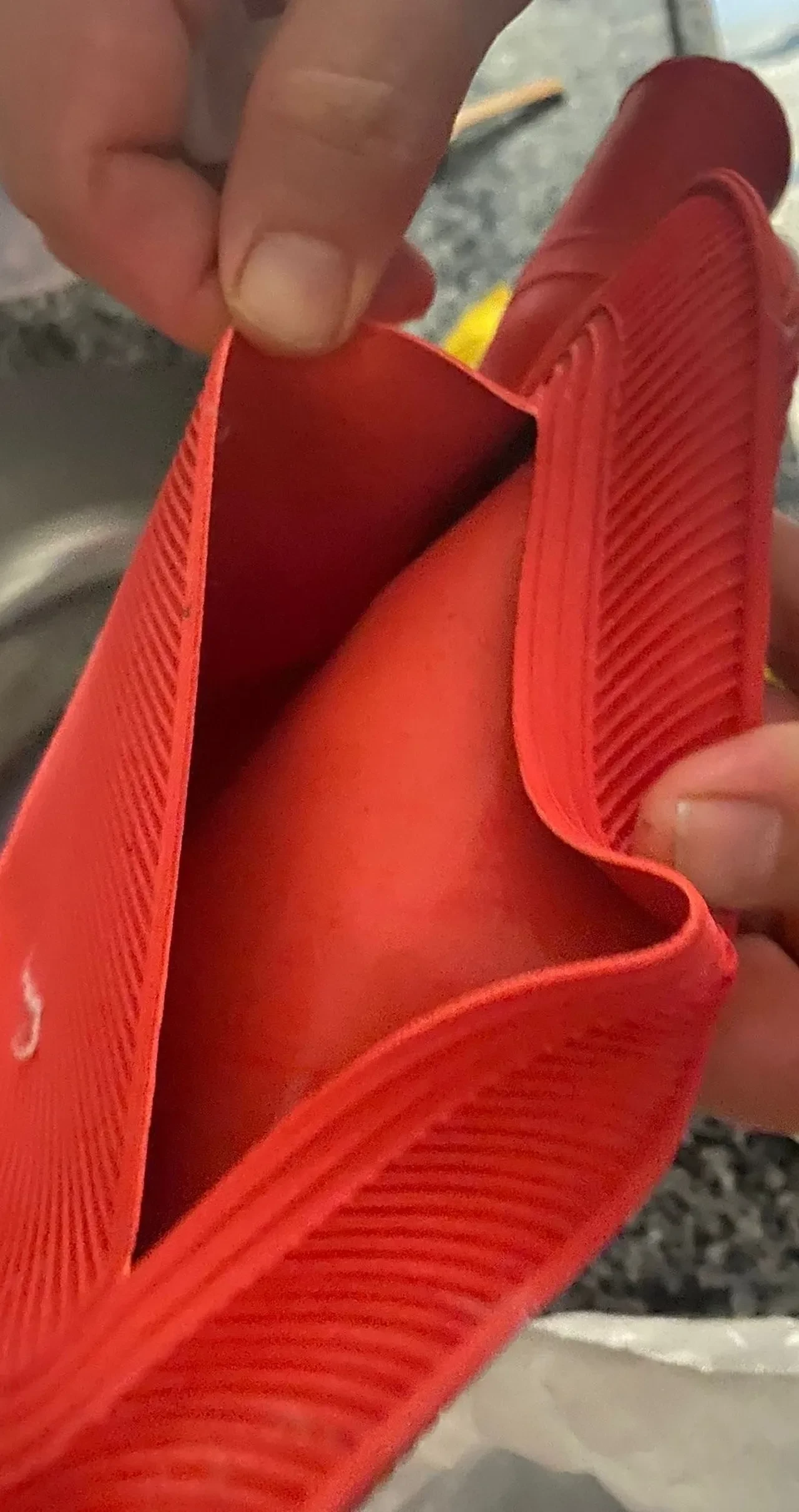 Ağrısını hafifletmek için sıcak su torbasına sarılanlar dikkat! Vücudunuz yanabilir: "Bu acının tarifi yok!"