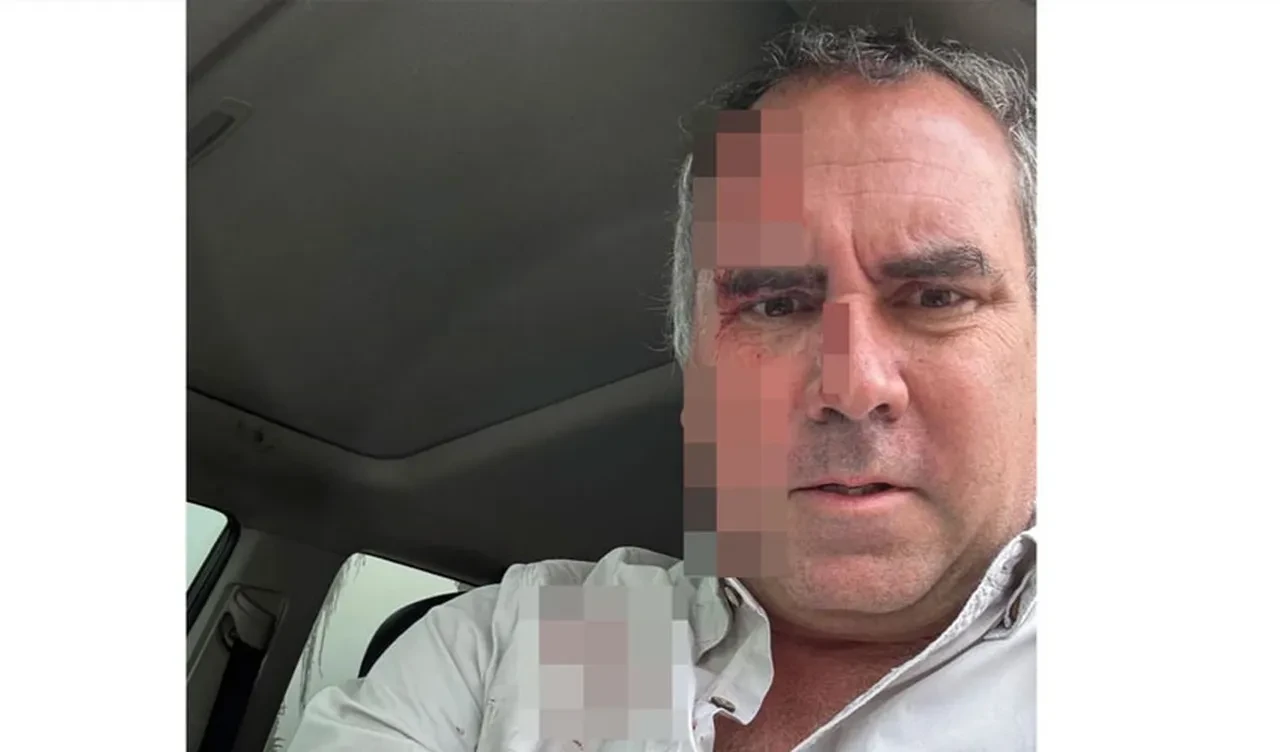 Cumhurbaşkanı adayına Peru'da suikast girişimi: Aracını kurşun yağmuruna tuttular