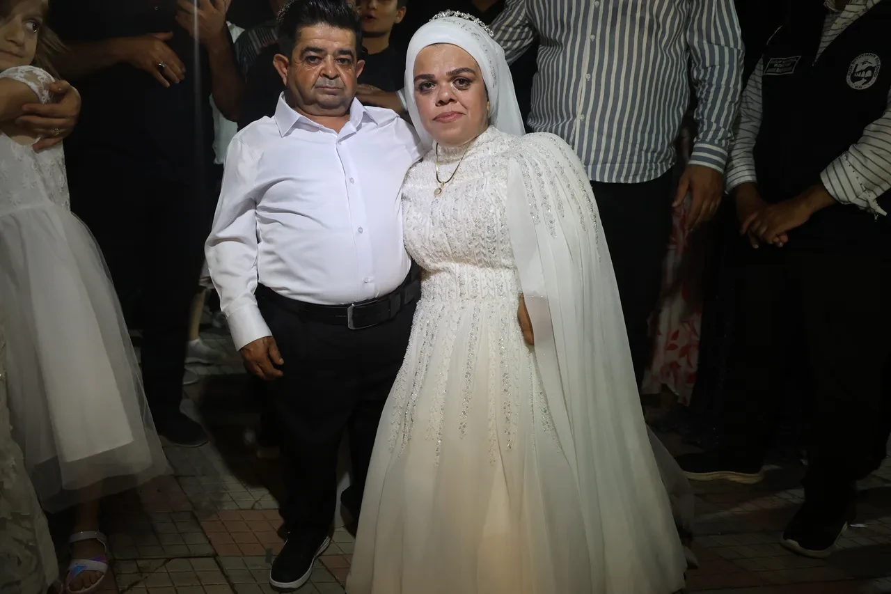 21 yıl önce nişan atan cüce çift, bu kez kaçarak evlendi!